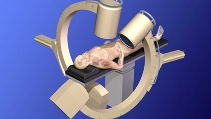 整形外科用 Ｘ線撮影装置 外科手術 整形外科 手術台 手術体位 Cアーム 整形外科 泌尿器 脳外科 腹部領域DSA撮像 X線移動型装置