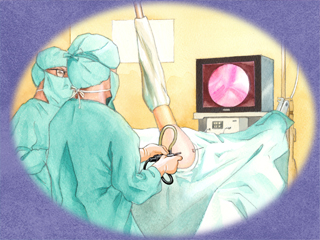 手術風景（イラスト） 整形外科 内視鏡手術 手術室