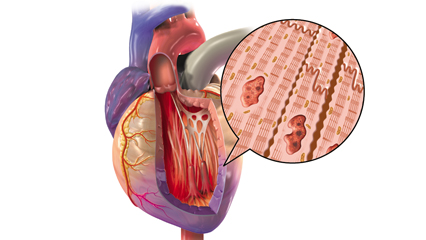 心臓断面（心筋細胞） 心不全 心筋梗塞 平滑筋細胞 内皮細胞 僧帽弁 右心房 左心房 右心室 左心室 上行大動脈 上大静脈 肺動脈 大動脈弓